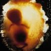 http://img2.xooimage.com/files/5/0/1/embryo-1ff90ac-1600x1200--1ff94c4.jpg